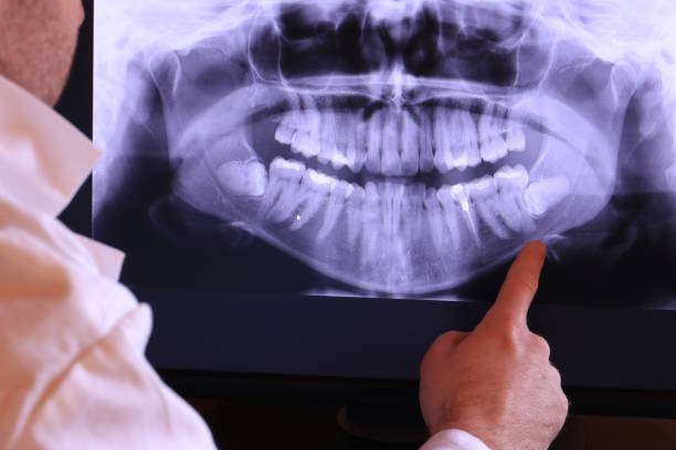Best Emergency Treatment for Oral Infections in Rodeo, CA